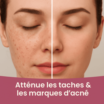 Soin anti taches - Korva Glow Pads